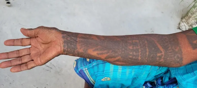 A fish tattoo on the hands of a woman